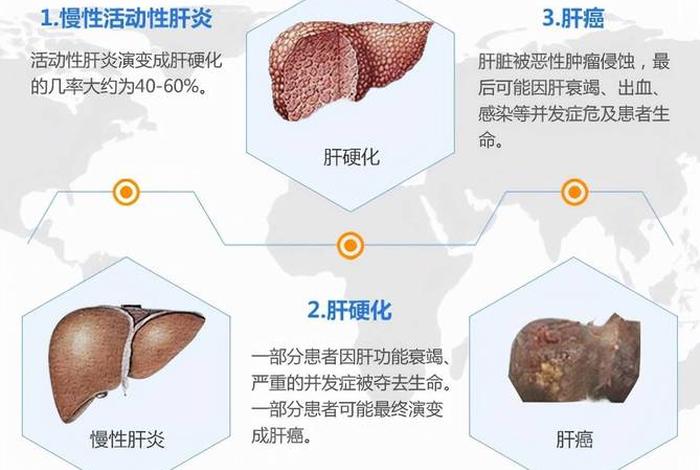 名人乙肝患者、名人乙肝患者是谁