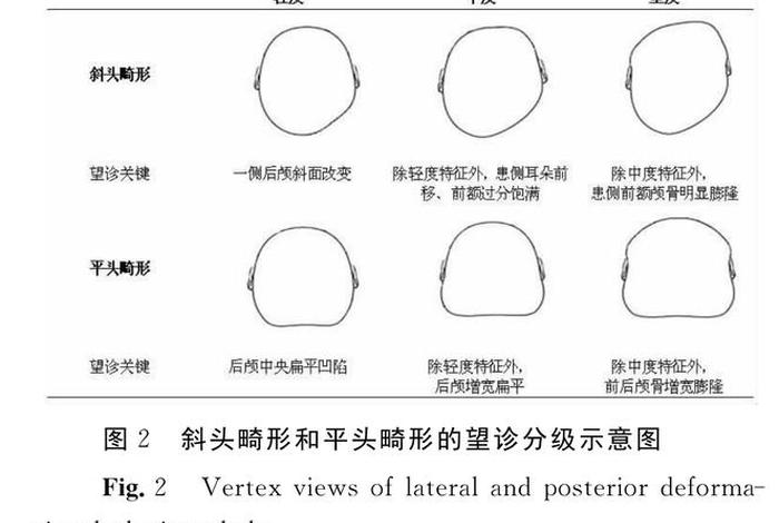 扁头的来历（扁头的由来）