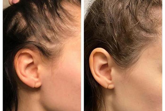 中国历史人物中的秃头是谁啊,中头名人 中国历史人物中的秃头是谁啊,中头名人