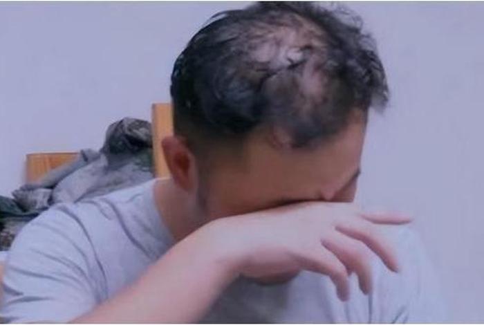 脱发的伟人 - 脱发的男艺人 脱发的伟人 - 脱发的男艺人