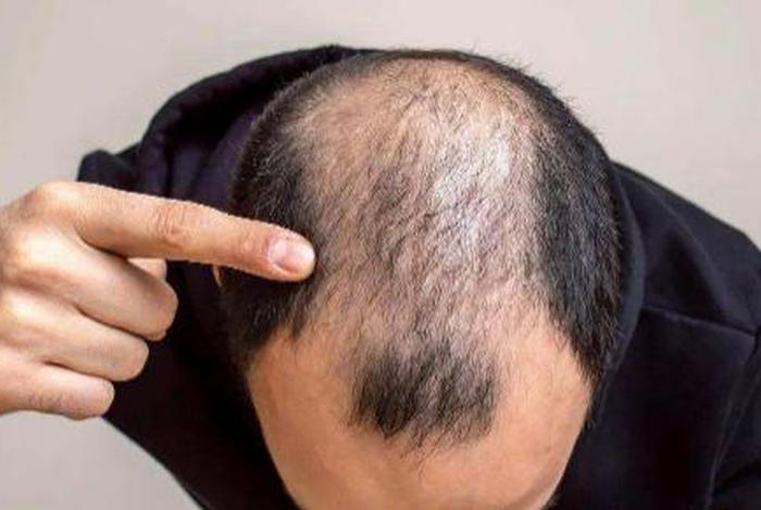 历史使人头秃 历史使人头秃的人物 历史使人头秃 历史使人头秃的人物