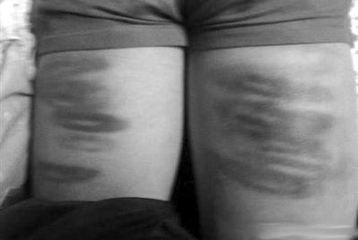 中国体罚学生;中国体罚学生情况严重 中国体罚学生;中国体罚学生情况严重