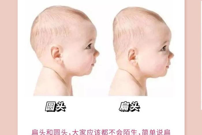 哪些名人是扁头 扁头人的性格 哪些名人是扁头 扁头人的性格