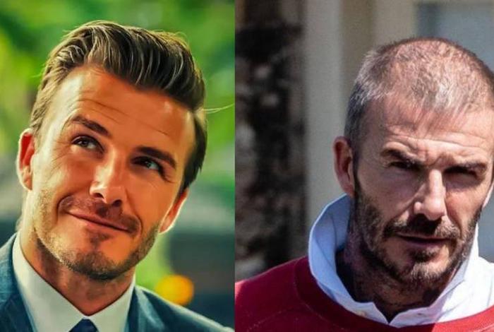 脱发的伟人 - 脱发的男艺人 脱发的伟人 - 脱发的男艺人