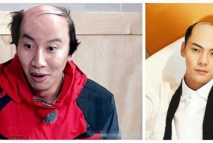 中国历史上的秃头（中国历史秃头名人）