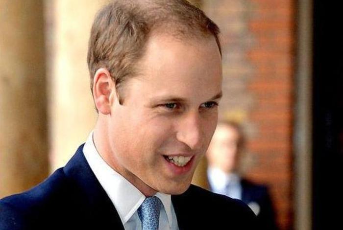 脱发的名人(脱发的故事) 脱发的名人(脱发的故事)