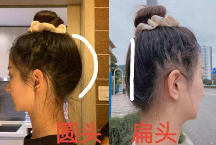 中国人的扁头是怎么形成的 - 中国人的扁头是怎么形成的呢 中国人的扁头是怎么形成的 - 中国人的扁头是怎么形成的呢