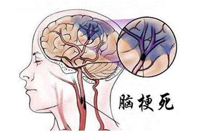 没有脑子的人是什么人(没有脑子的人会怎么样) 没有脑子的人是什么人(没有脑子的人会怎么样)