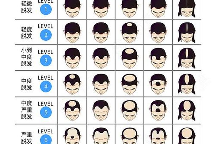 历史上的脱发人群,脱发的原型 历史上的脱发人群,脱发的原型