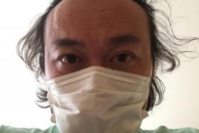 历史上秃头的人寿命最长图片，秃头的历史人物