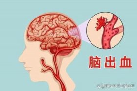 没有脑子的人会怎么样，没有脑子的人会怎么样图片
