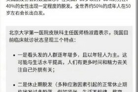 中国的秃头人数 中头概率