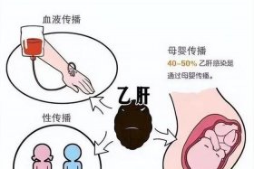 历史上得过乙肝的名人，乙肝名人录