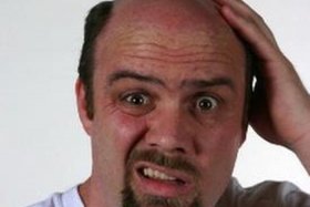 秃头代表人物、秃头代表人物有哪些