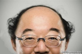 历史上秃头代表人物 秃头的代表人物