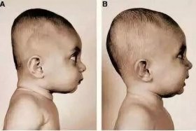 历史上扁头的名人；扁头的伟人